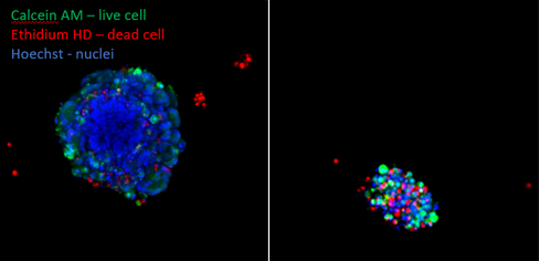 organoidi del cancro colorettale