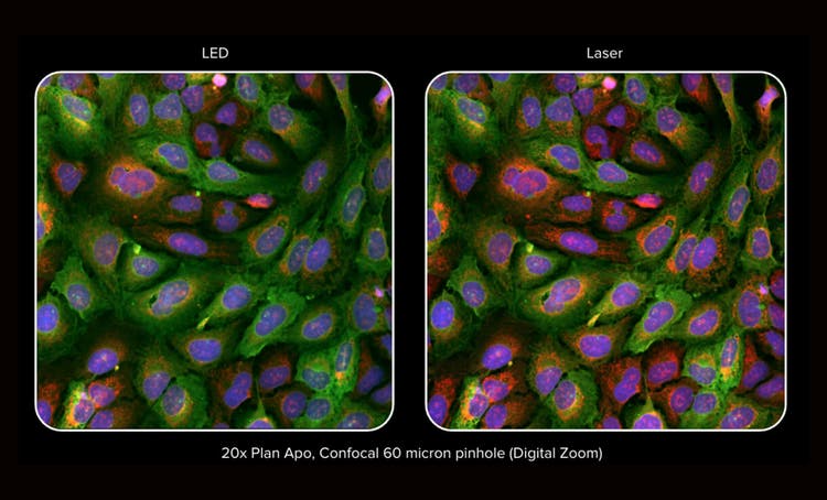 Scansione laser 3D Lungo tempo di acquisizione