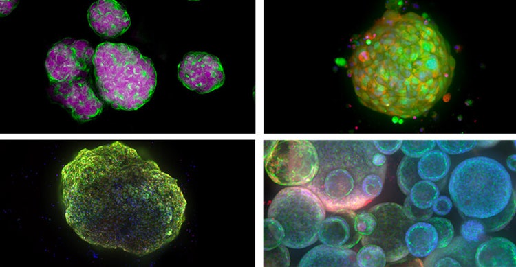 Esempi di modelli di cellule 3D - Sferoidi, organoidi derivati dal paziente, cardioide (organoide del cuore) e organoidi del polmone
