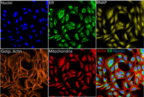 Cell Painting assay