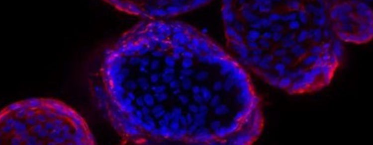 Duodenal adenoma organoids