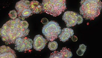 Patient-derived colorectal cancer organoid stained with Hoechst (blue) for nuclei, phalloidin (green) for actin filament, and MitoTracker (red) for mitochondria