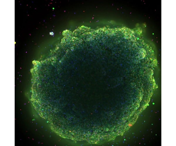 Liver-Derived Organoids