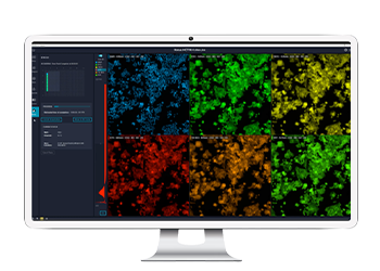 Software di acquisizione di immagini MetaXpress
