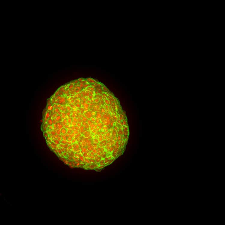 HT.ai Organoide con overlay di piani z