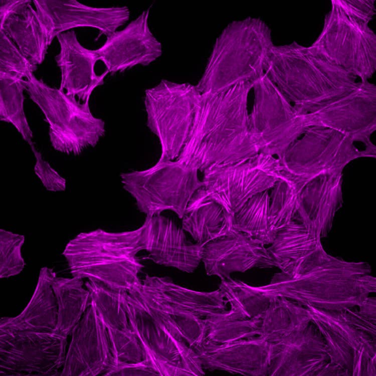 Organoide HT.ai 