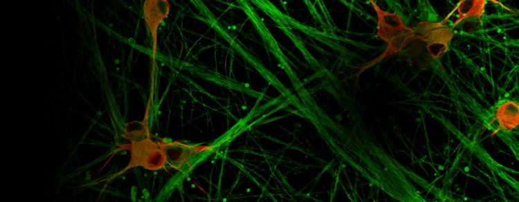 Imaging di cellule staminali