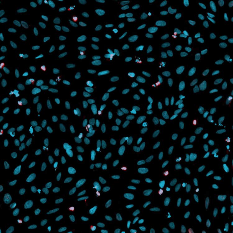 Overlay del danno al DNA in cellule U2OS con il sistema ImageXpress Nano