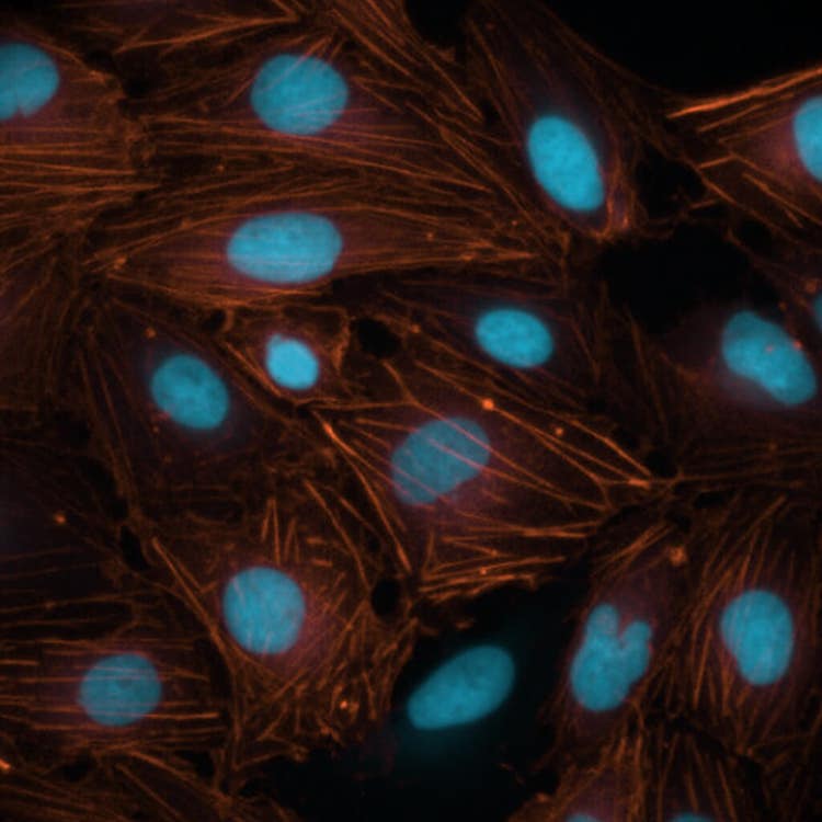 Nuclei con il colorante falloidina a un ingrandimento 60X utilizzando il sistema ImageXpress Nano
