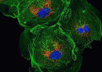 Scoperta e ottimizzazione di immunogeni