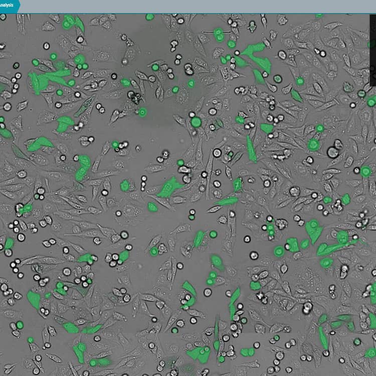 Overlay di luce trasmessa e GFP utilizzando il software CellReporterXpress sul sistema ImageXpress Nano