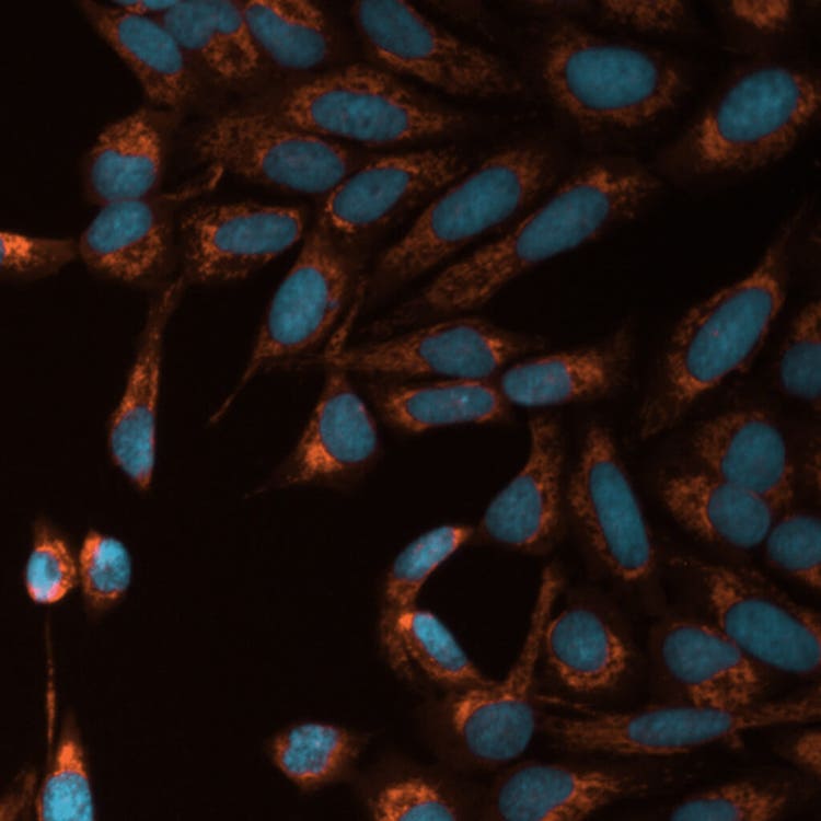 Tossicità mitocondriale con TRITC e DAPI utilizzando il sistema ImageXpress Pico