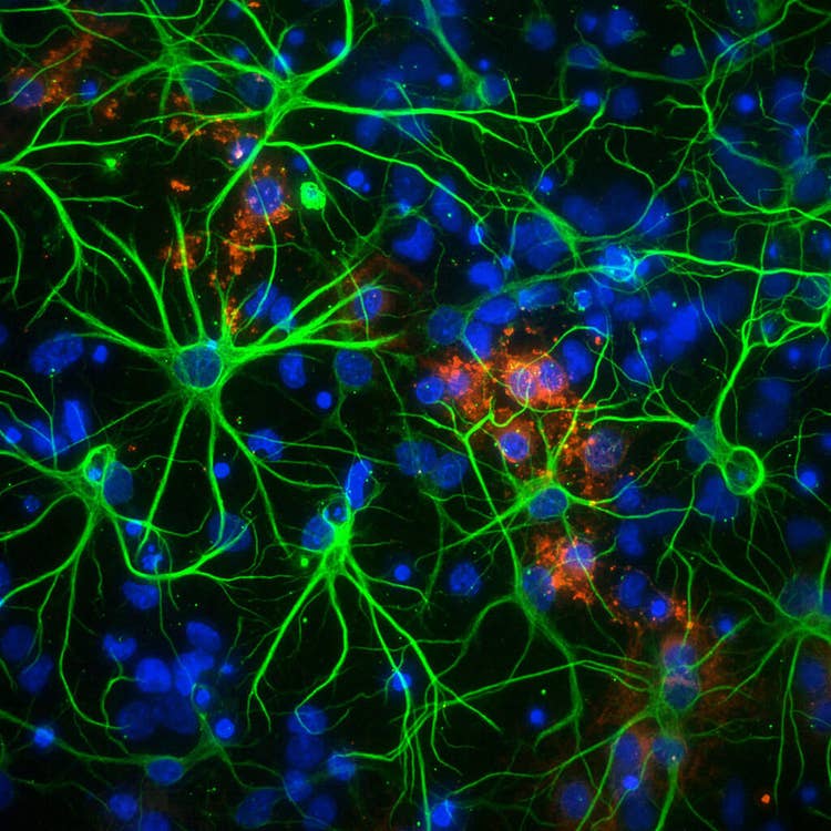 Neuroni in piastra a 1536 pozzetti a un ingrandimento 60X PA con il sistema ImageXpress Micro Confocal