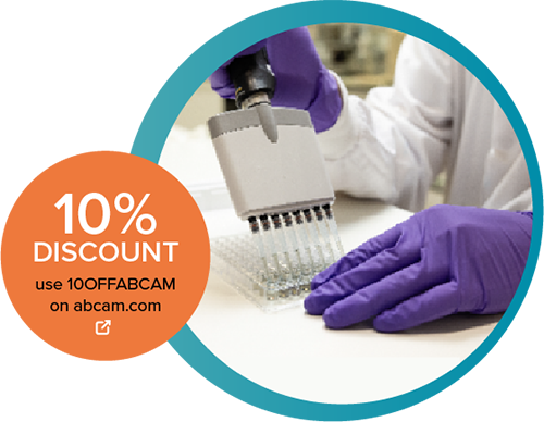 Lavorare con i kit ELISA SimpleStep