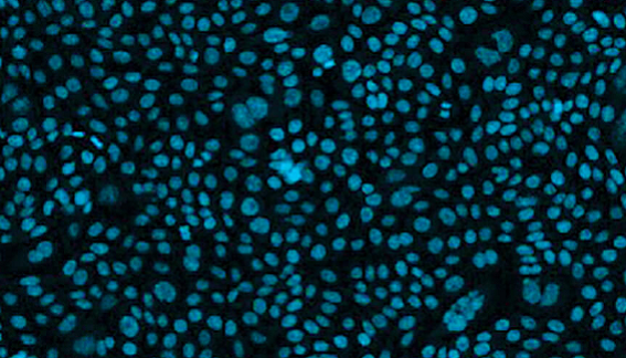Evoluzione del ruolo delle cellule CHO nello sviluppo di linee cellulari