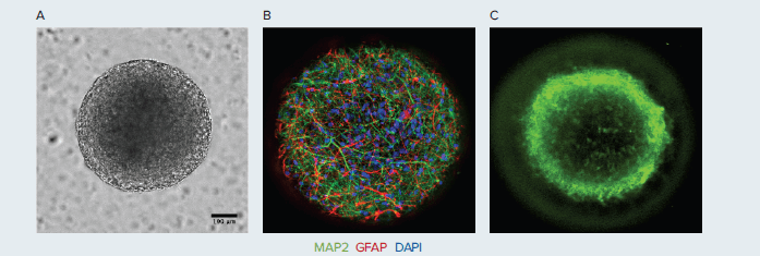 Human iPSC-derived neural spheroids- MAP2, GFAP, DAPI