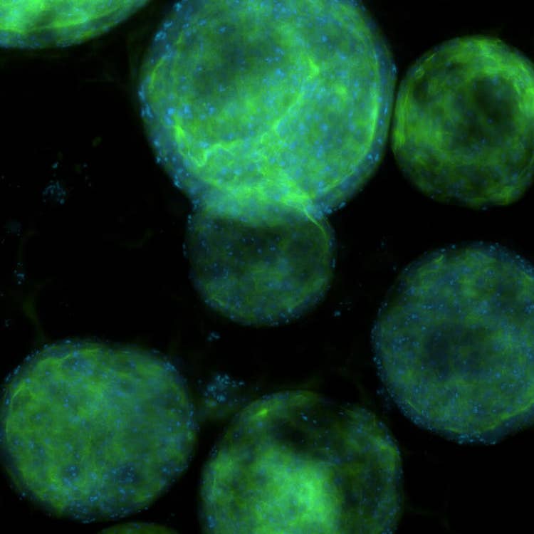 C2 in organoidi polmonari