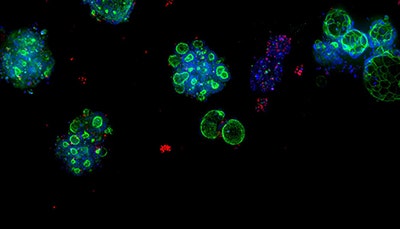 TECNOLOGIA DEI BIOPROCESSI