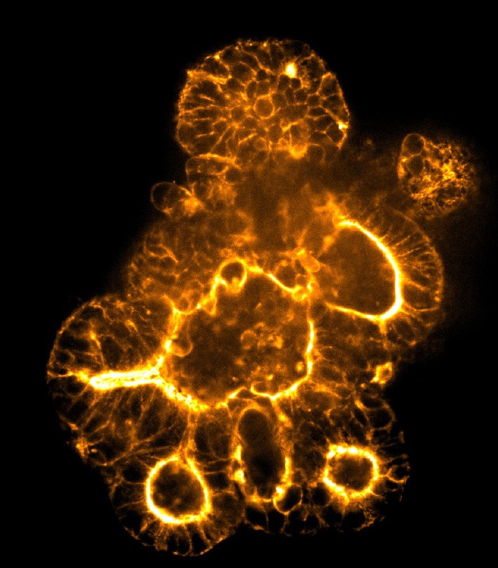Disco rotante per i tessuti profondi