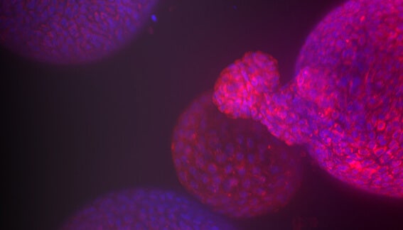 Emerging Organoid Models